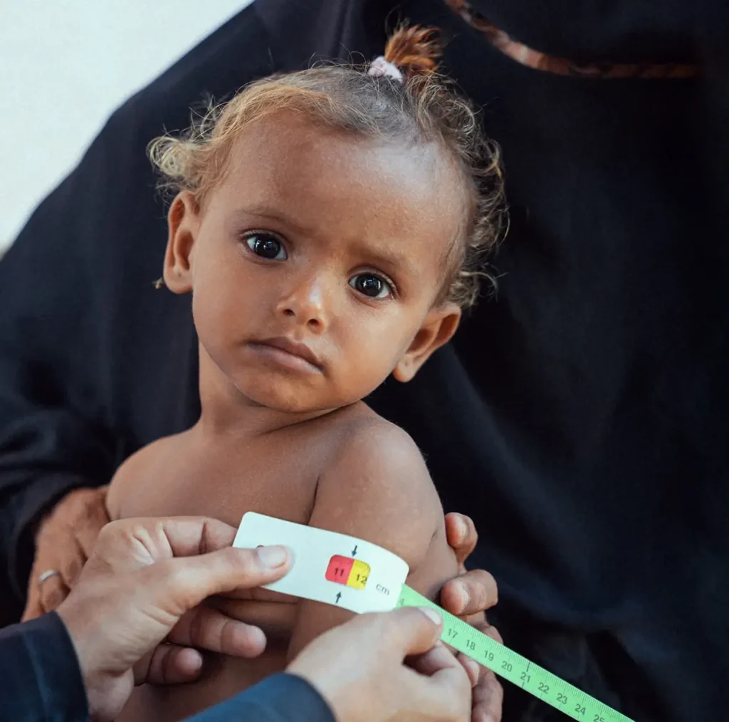Et lille barn får medicinsk behandling i armene på en voksen, som viser betydningen af UNICEF’s arbejde med sundhed og livreddende hjælp til børn